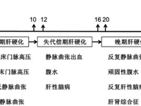 肝病科 | 门静脉高压危重症救治的管理与MDT